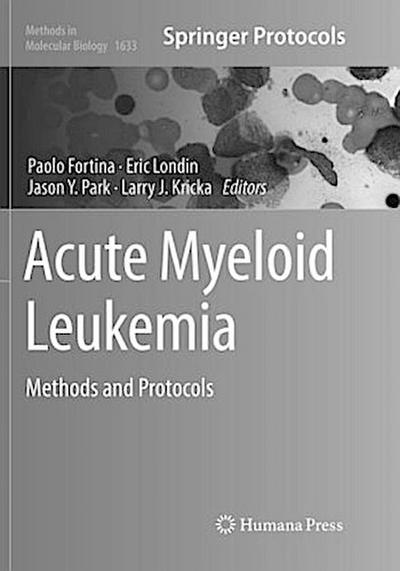 Acute Myeloid Leukemia
