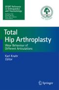 Total Hip Arthroplasty: Wear Behaviour of Different Articulations