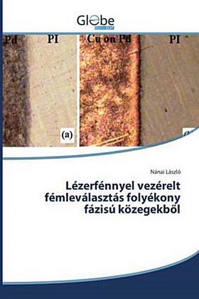 Lézerfénnyel vezérelt fémleválasztás folyékony fázisú közegekb¿l