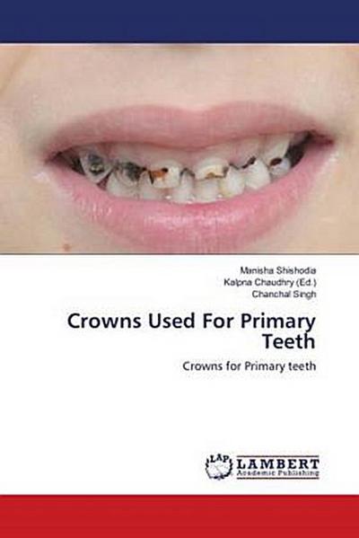 Crowns Used For Primary Teeth