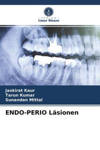 ENDO-PERIO Läsionen