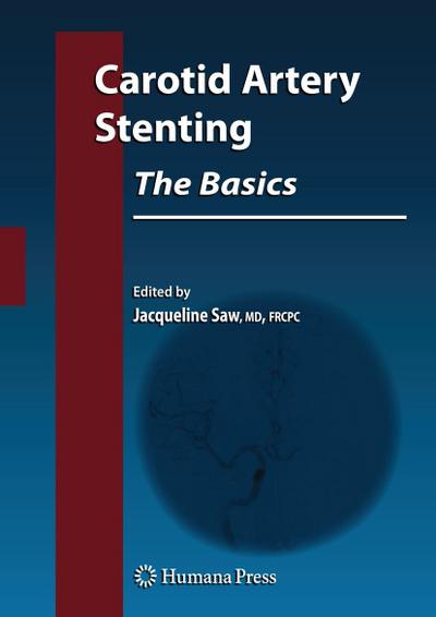 Carotid Artery Stenting: The Basics