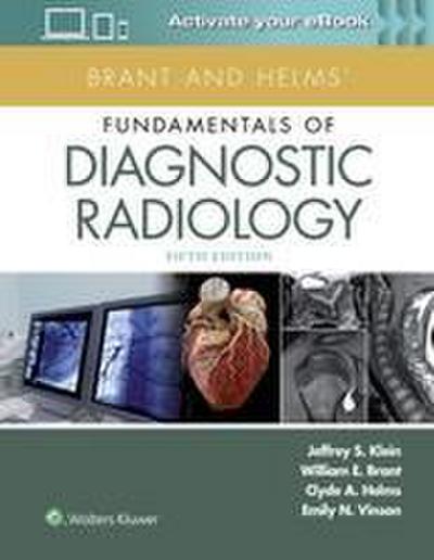 Brant and Helms’ Fundamentals of Diagnostic Radiology