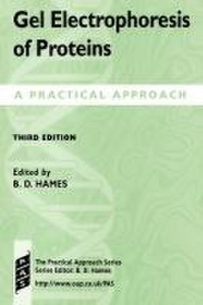 Gel Electrophoresis of Proteins