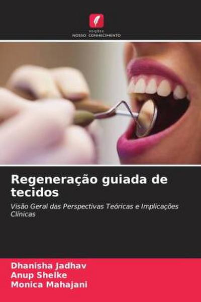 Regeneração guiada de tecidos