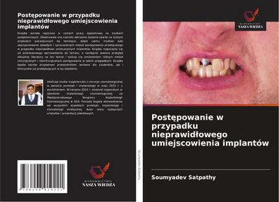 Post¿powanie w przypadku nieprawid¿owego umiejscowienia implantów