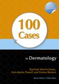 100 Cases in Dermatology