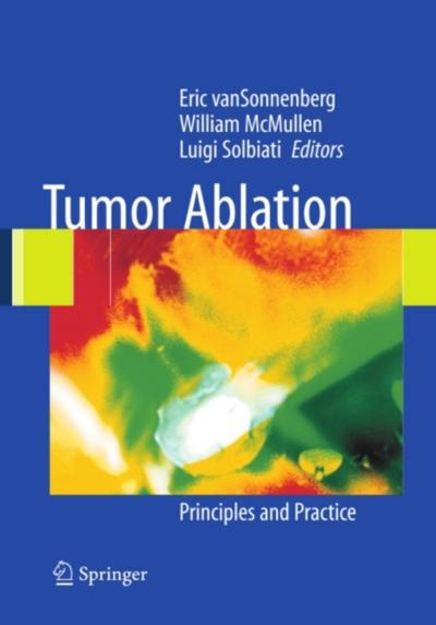 Tumor Ablation