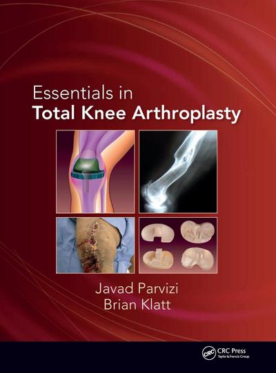 Essentials in Total Knee Arthroplasty