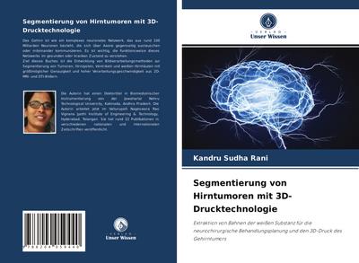Segmentierung von Hirntumoren mit 3D-Drucktechnologie