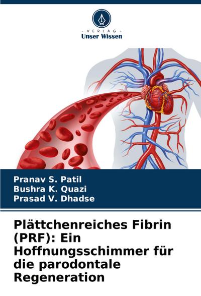 Plättchenreiches Fibrin (PRF): Ein Hoffnungsschimmer für die parodontale Regeneration