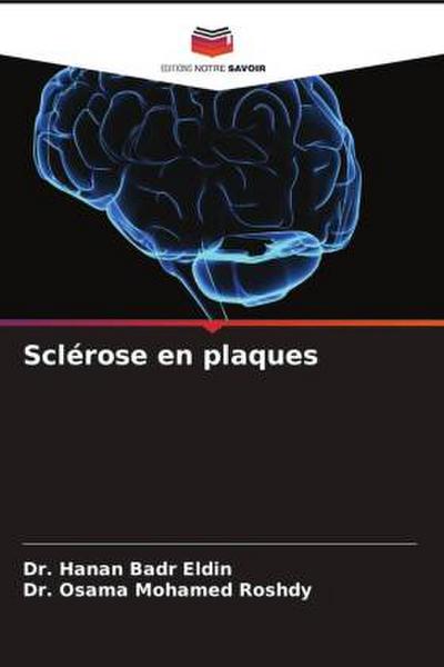 Sclérose en plaques