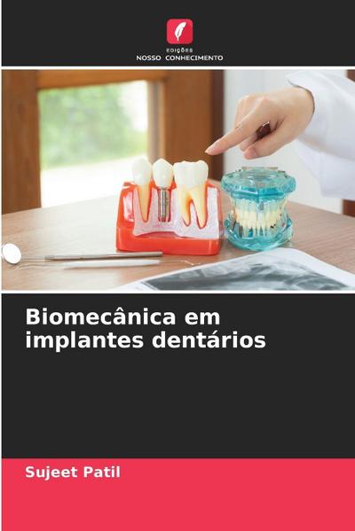 Biomecânica em implantes dentários