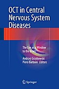 OCT in Central Nervous System Diseases