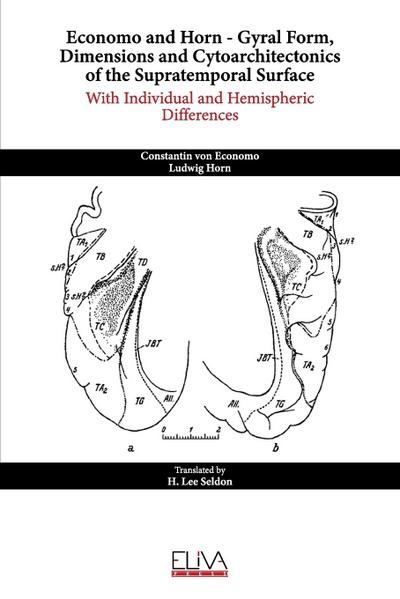 Economo and Horn - Gyral Form, Dimensions and Cytoarchitectonics of the Supratemporal Surface