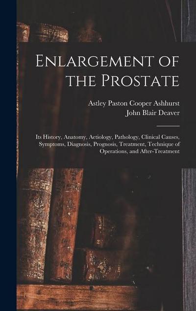 Enlargement of the Prostate: Its History, Anatomy, Aetiology, Pathology, Clinical Causes, Symptoms, Diagnosis, Prognosis, Treatment, Technique of O