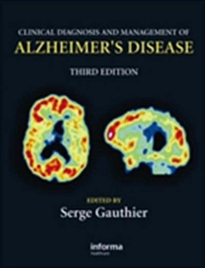 Clinical Diagnosis and Management of Alzheimer’s Disease