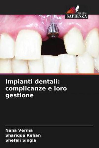 Impianti dentali: complicanze e loro gestione