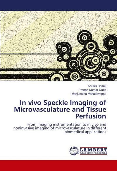 In vivo Speckle Imaging of Microvasculature and Tissue Perfusion