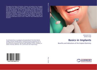 Basics in Implants