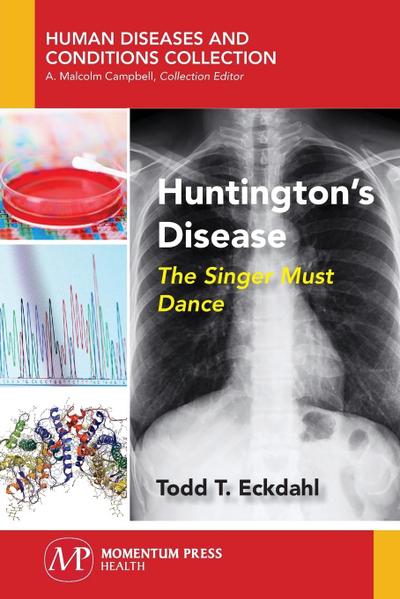 Huntington’s Disease