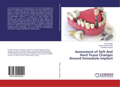 Assessment of Soft And Hard Tissue Changes Around Immediate Implant