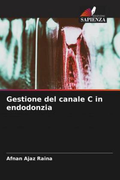 Gestione del canale C in endodonzia