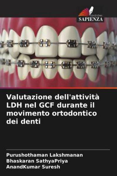 Valutazione dell’attività LDH nel GCF durante il movimento ortodontico dei denti