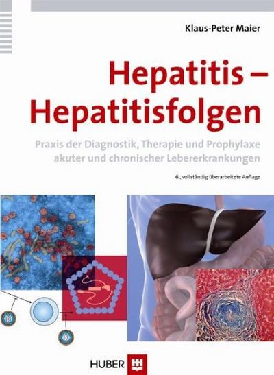 Hepatitis - Hepatitisfolgen. Praxis der Diagnostik, Therapie und Prophylaxe akuter und chronischer Lebererkrankungen