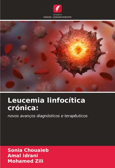 Leucemia linfocítica crónica: