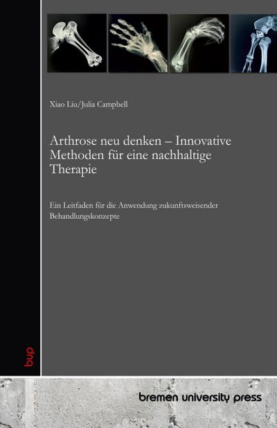 Arthrose neu denken - Innovative Methoden für eine nachhaltige Therapie