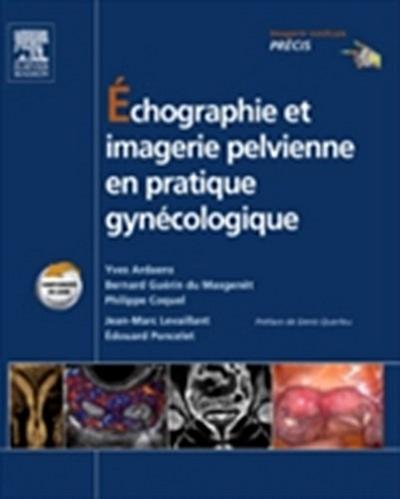 Échographie et imagerie pelvienne en pratique gynécologique