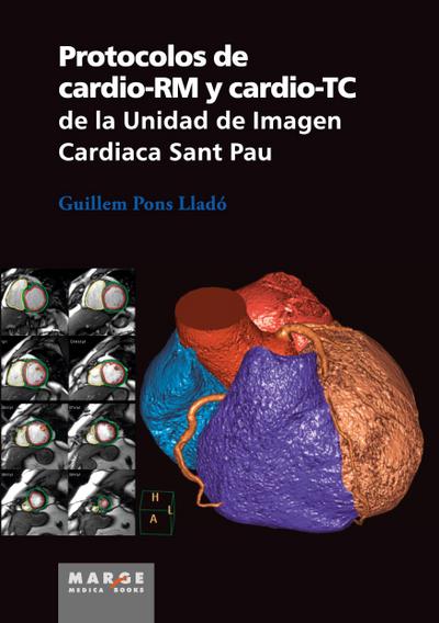 Protocolos de cardio-RM y cardio-TC de la Unidad de Imagen Cardiaca Sant Pau
