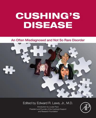 Cushing’s Disease