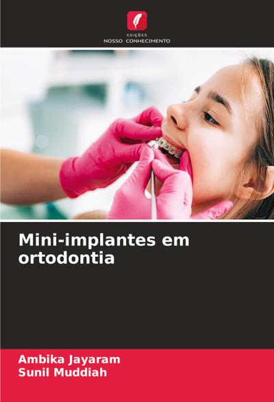 Mini-implantes em ortodontia