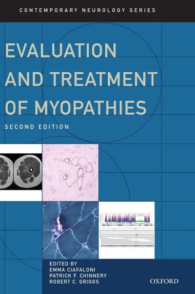Evaluation and Treatment of Myopathies