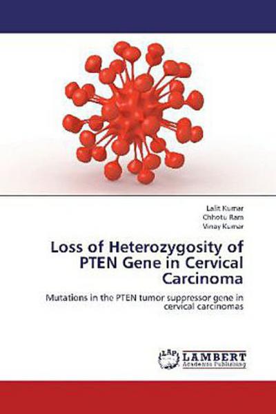 Loss of Heterozygosity of PTEN Gene in Cervical Carcinoma