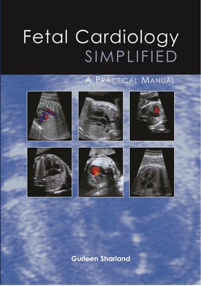 Fetal Cardiology Simplified
