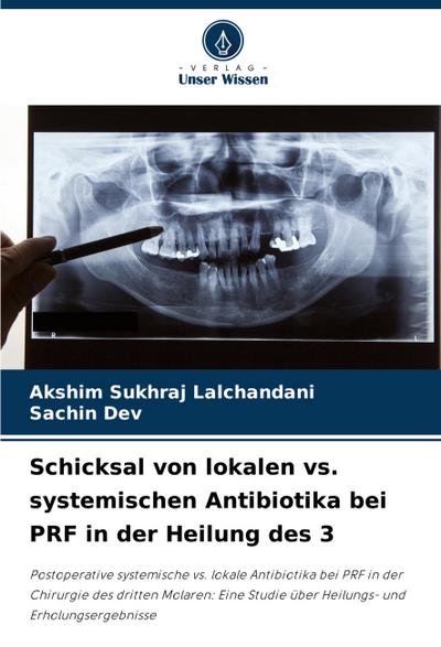 Schicksal von lokalen vs. systemischen Antibiotika bei PRF in der Heilung des 3