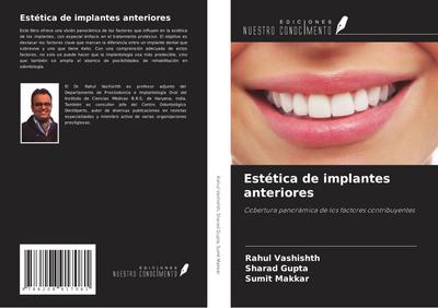 Estética de implantes anteriores