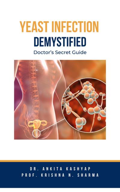 Yeast Infection: Demystified Doctor’s Secret Guide