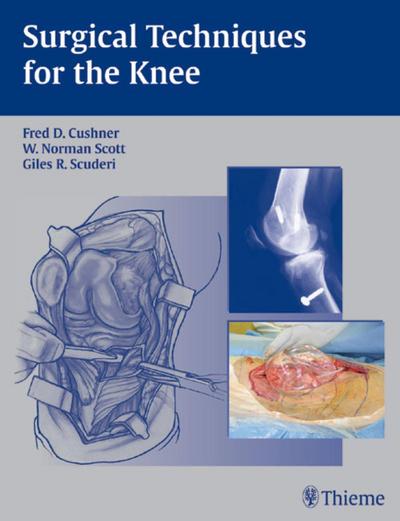 Surgical Techniques for the Knee