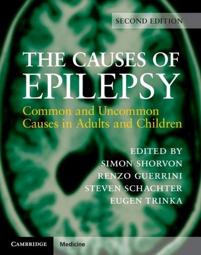 Causes of Epilepsy