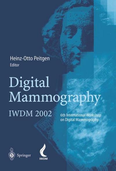 Digital Mammography
