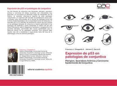 Expresión de p53 en patologías de conjuntiva