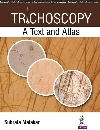 Trichoscopy