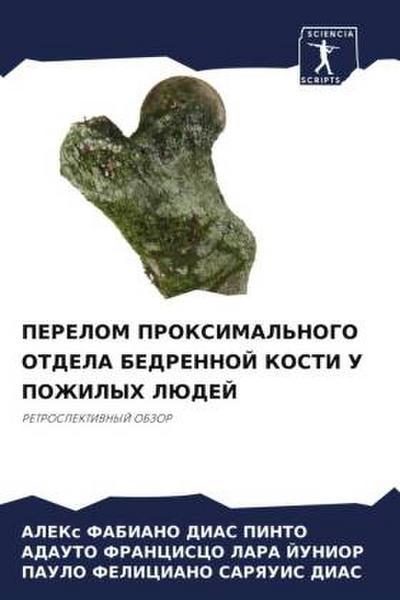 PERELOM PROKSIMAL’NOGO OTDELA BEDRENNOJ KOSTI U POZhILYH LJuDEJ