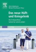 Das neue Hüft- und Kniegelenk