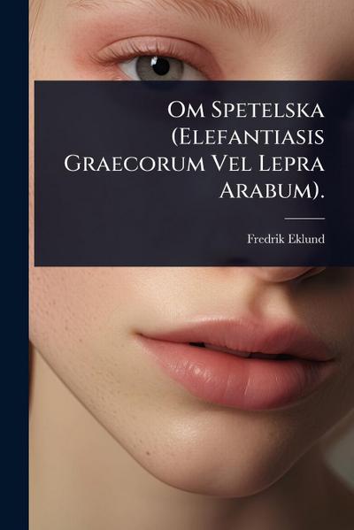 Om Spetelska (Elefantiasis Graecorum Vel Lepra Arabum).