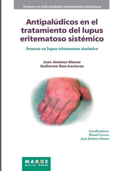 Antipalúdicos en el tratamiento del lupus eritematoso sistémico
